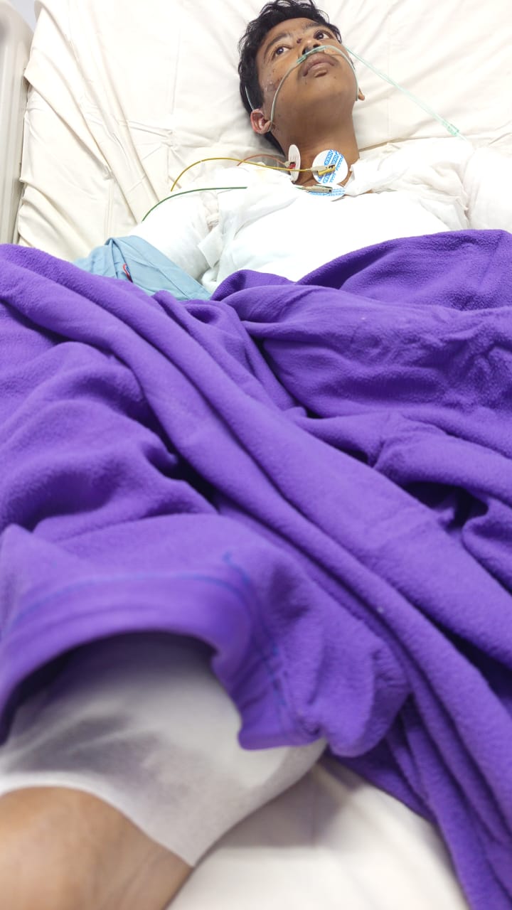 Fathier, Pekerja Internet yang Terbakar Arus Listrik dan Terlupakan Tanggung Jawab Perusahaan